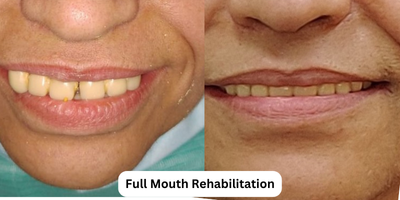 Cosmetic Dentistry